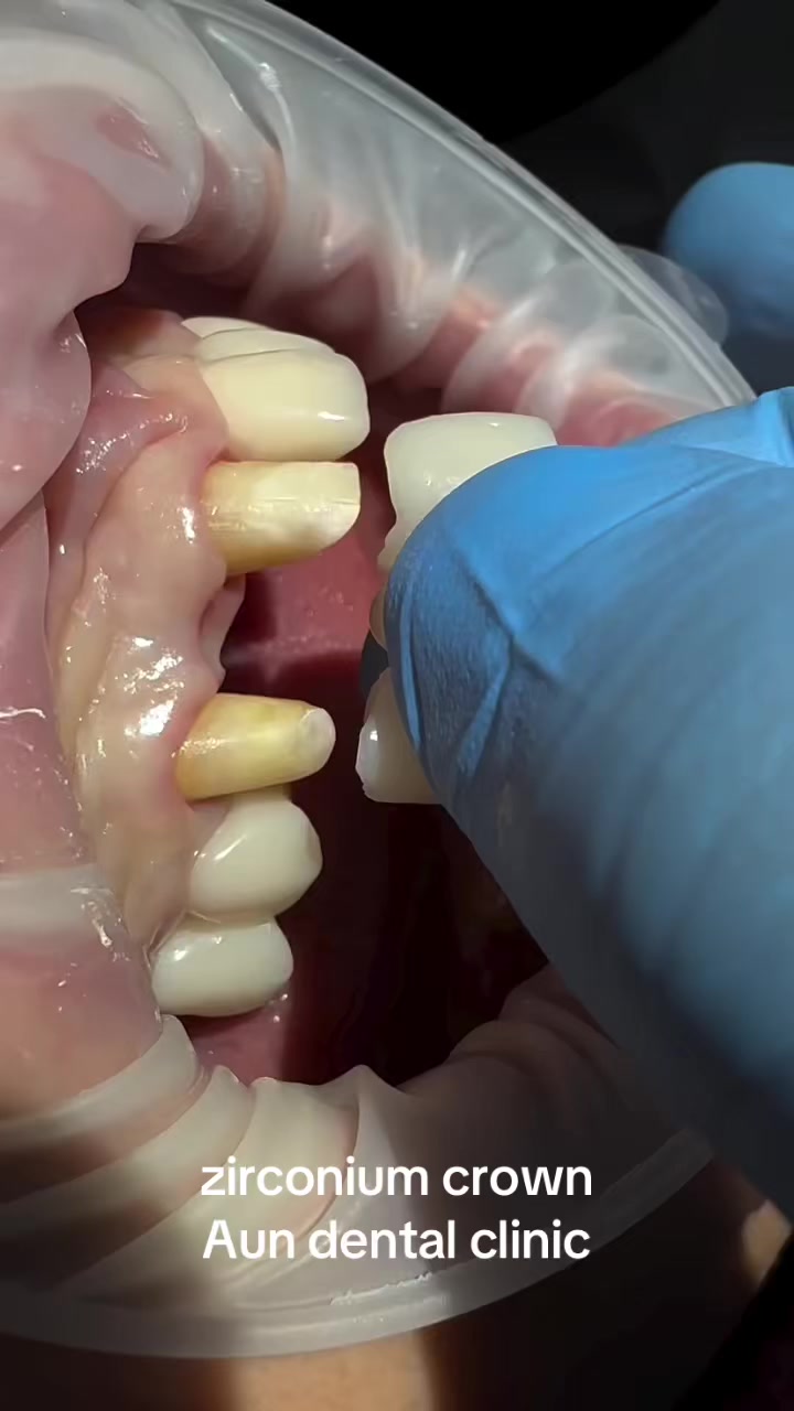 @Aun dental clinic ❤️