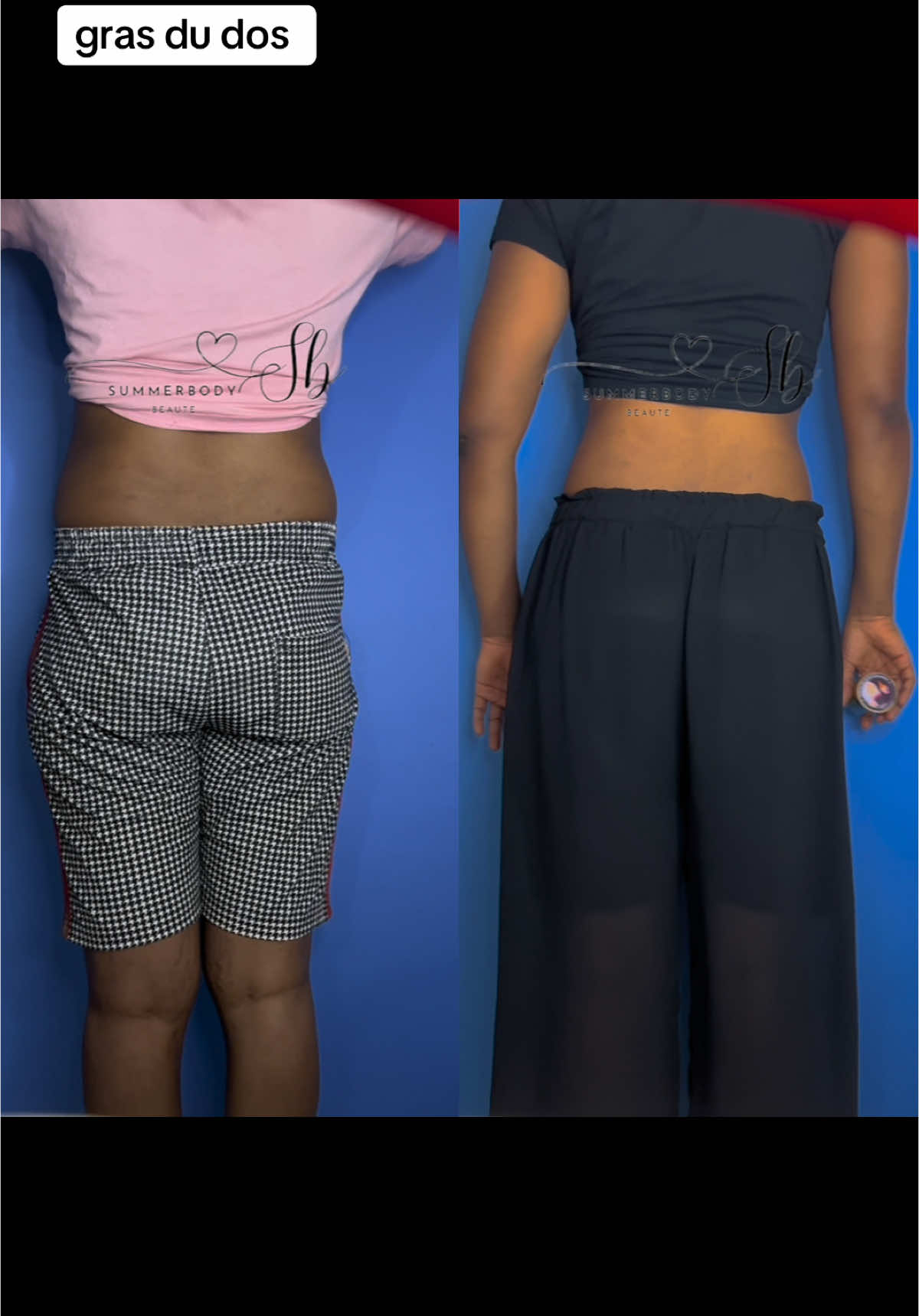 @summerbody