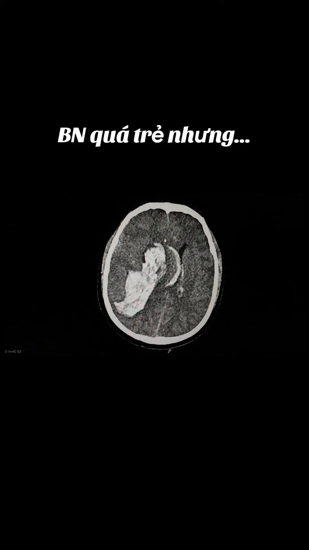 @Nguyễn Văn Tùng