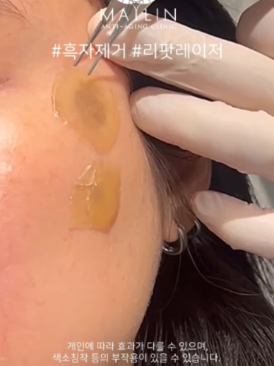 @메이린의원대구점