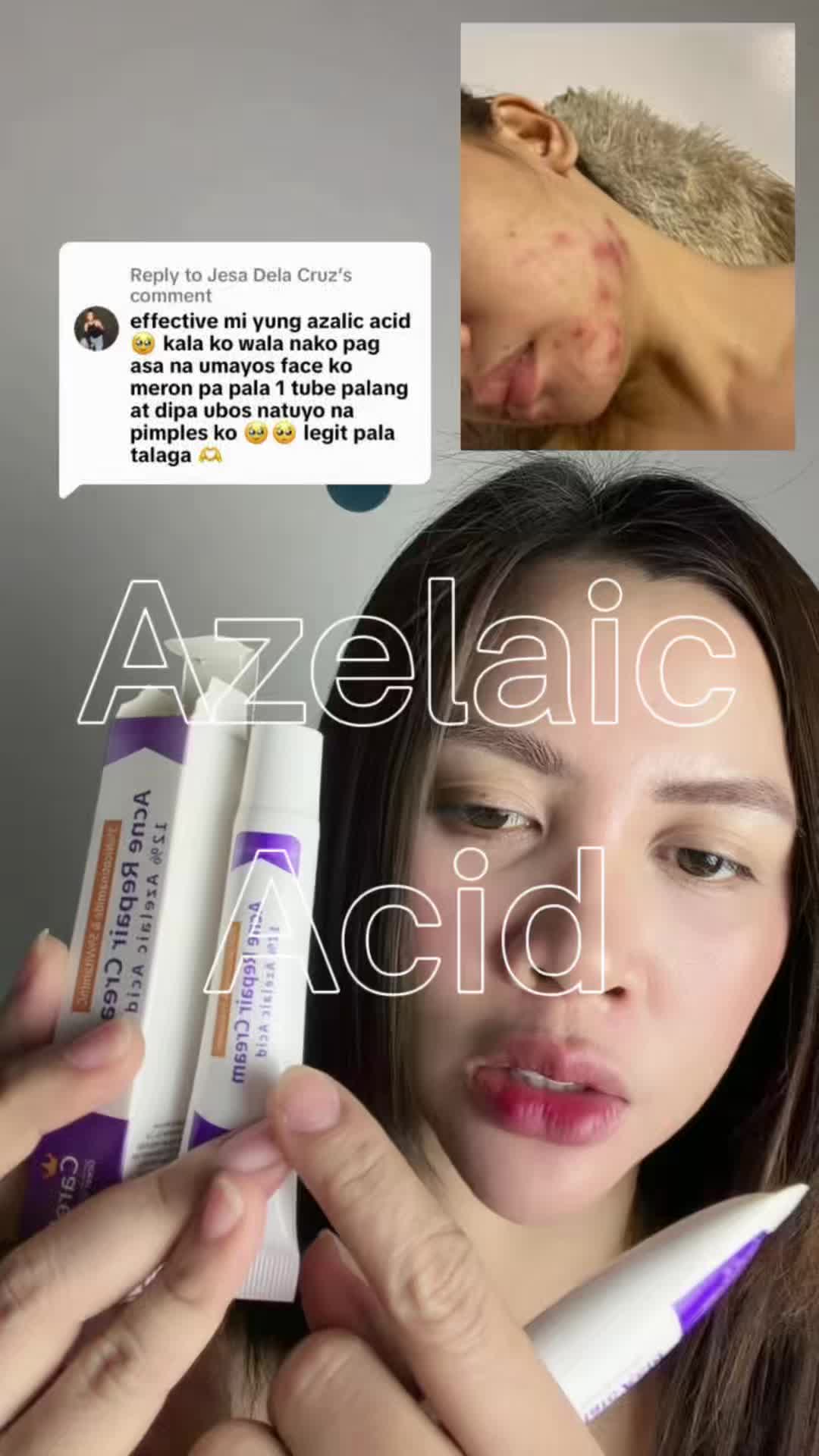 @Ally Feedback Ph