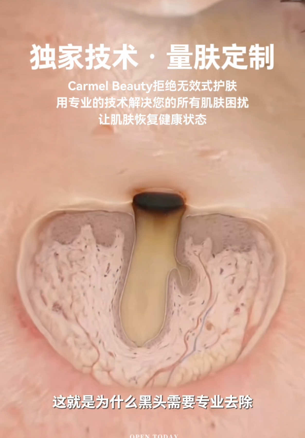 @Carmen皮肤问题杀手🥷