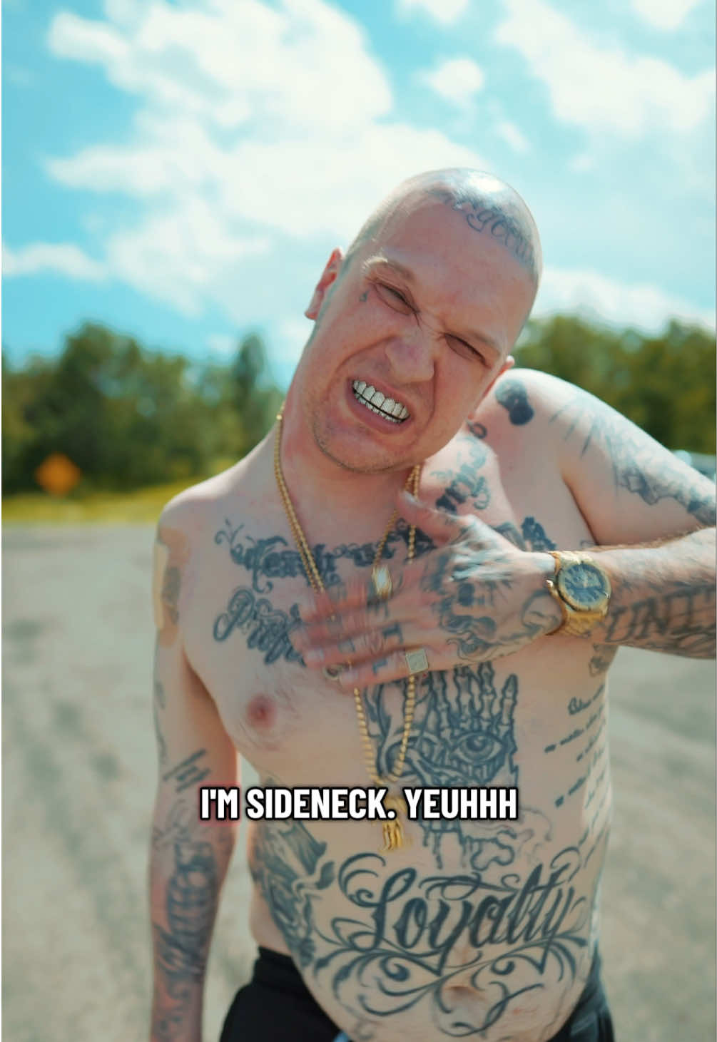 @Sideneck