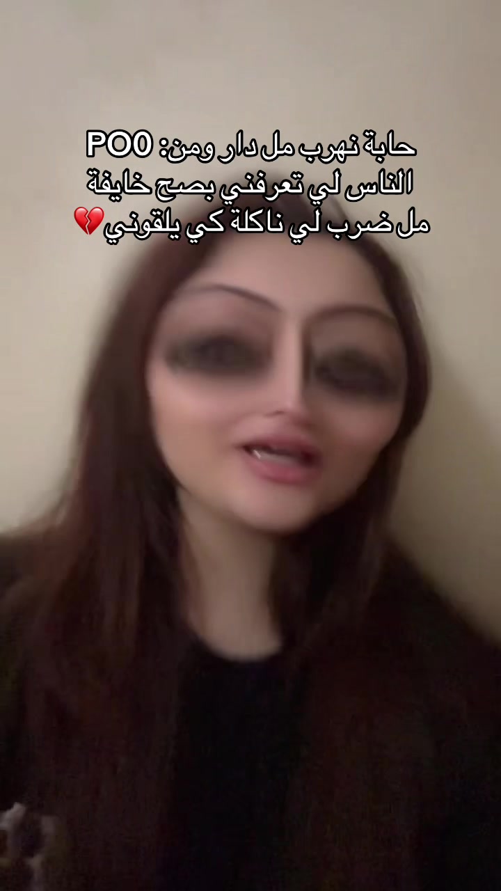 @Alouaa😝🫶🏻