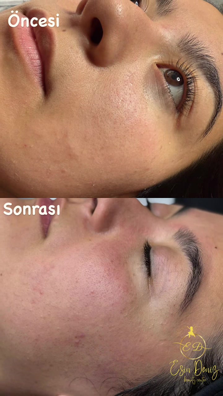 @Esin Deniz Beauty center