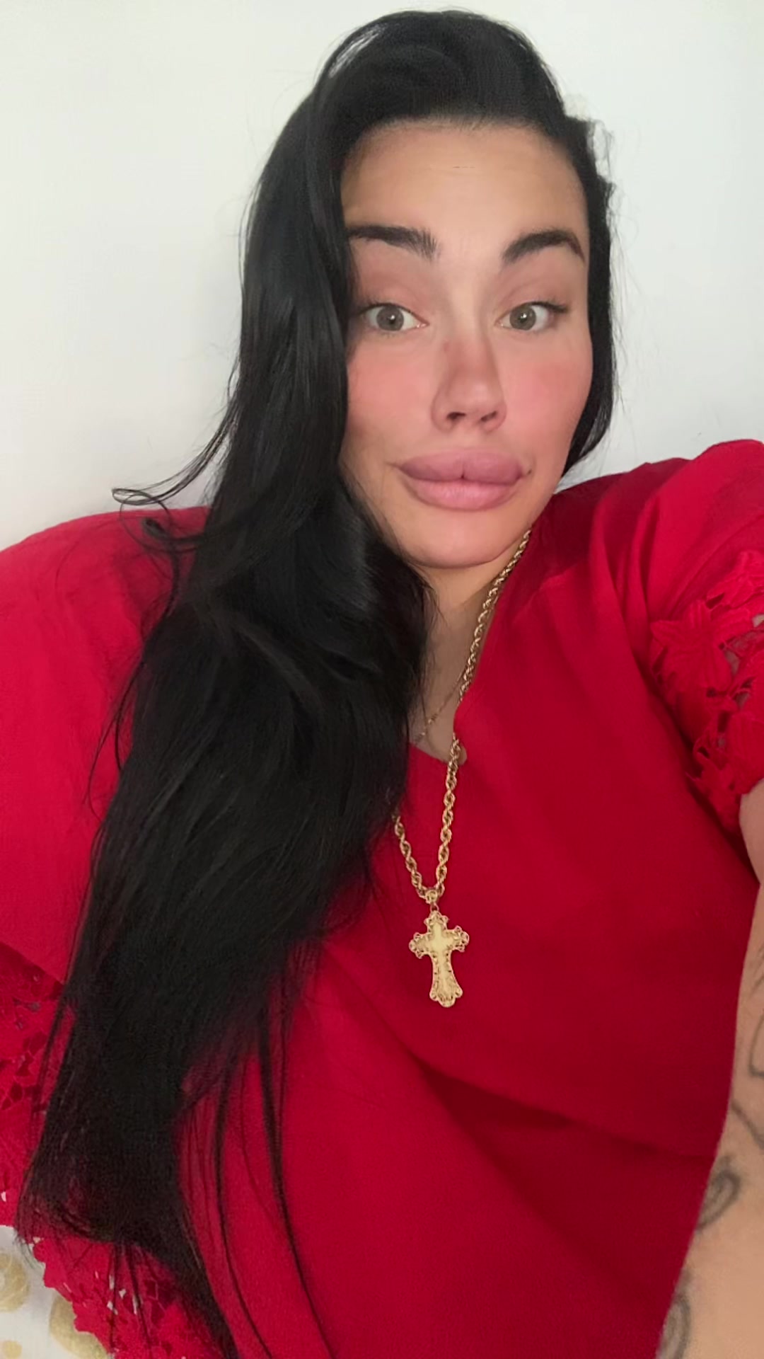 @Alessia albino