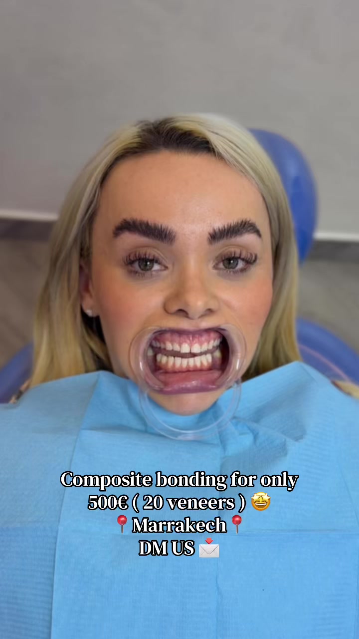 @Smilesecret