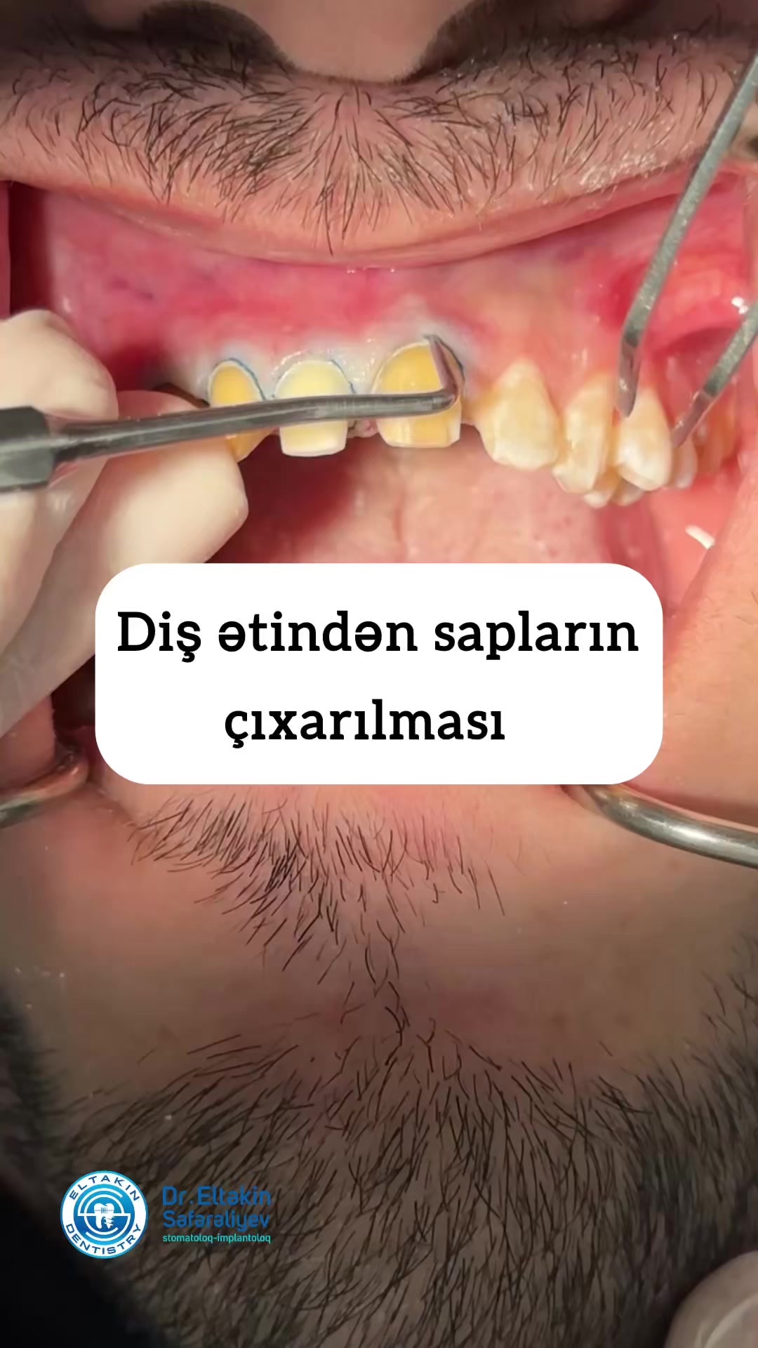 @eltakindentistry