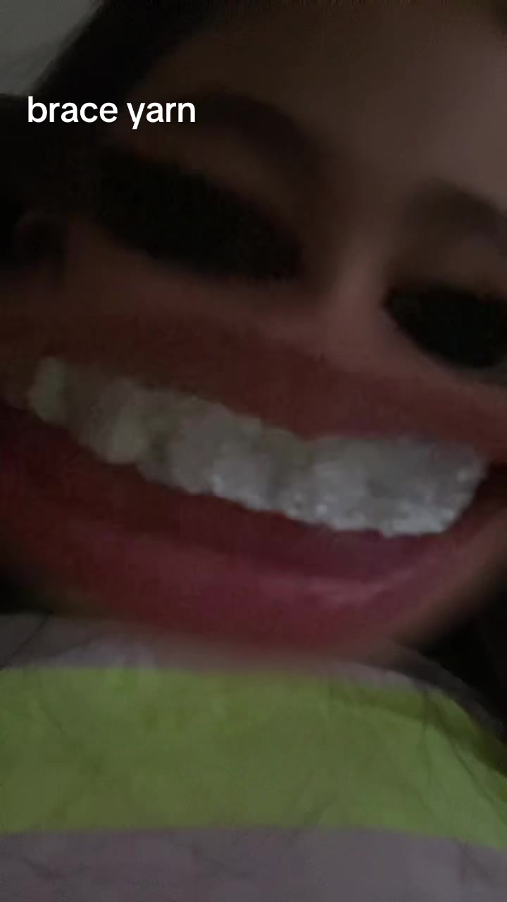 @Francin Angela