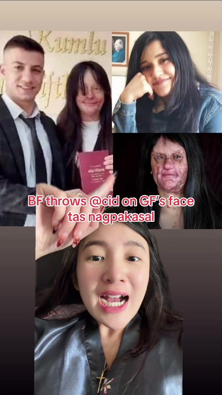 @Therese Tiangco