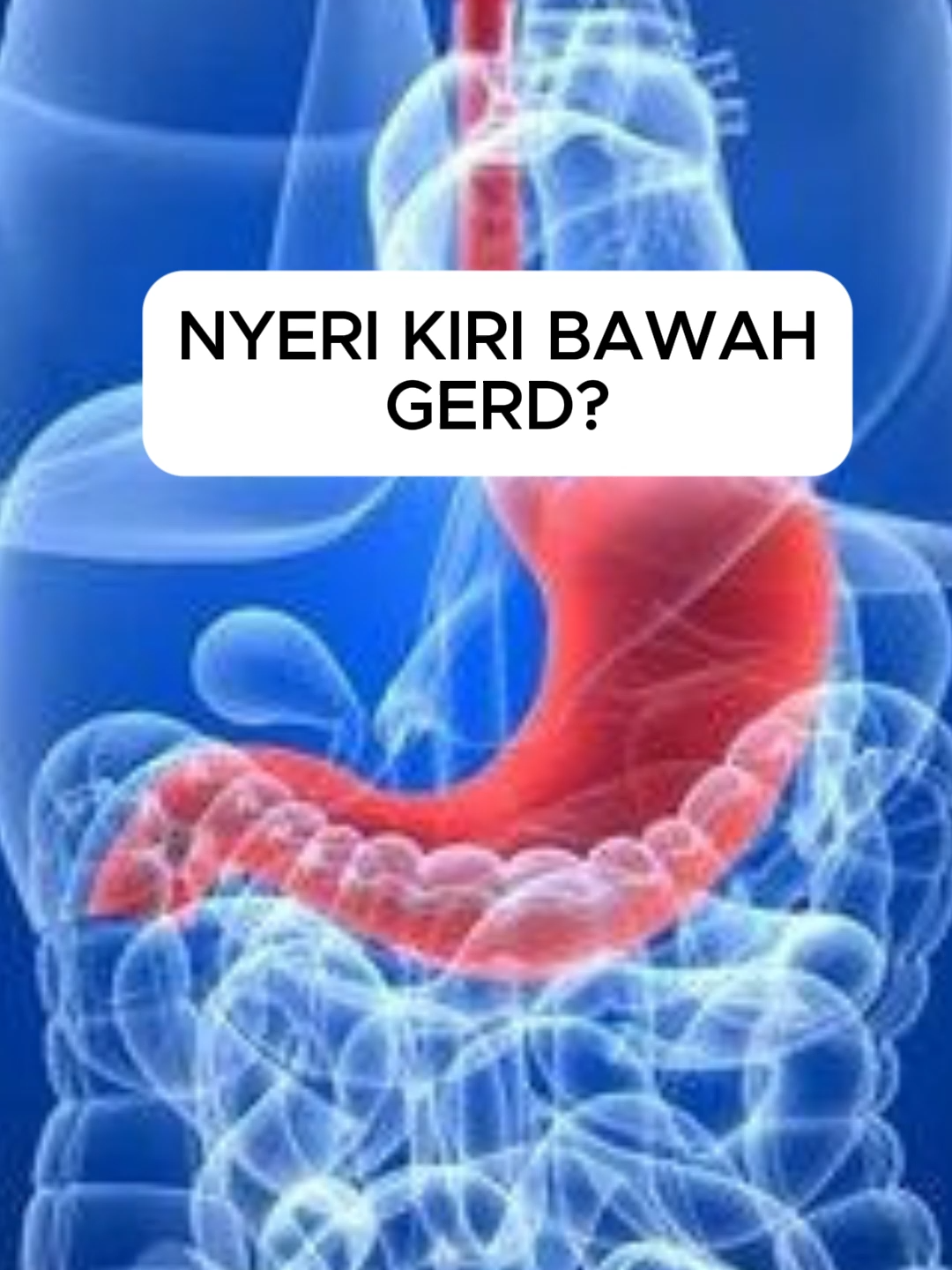 @Erik Wibowo ♋