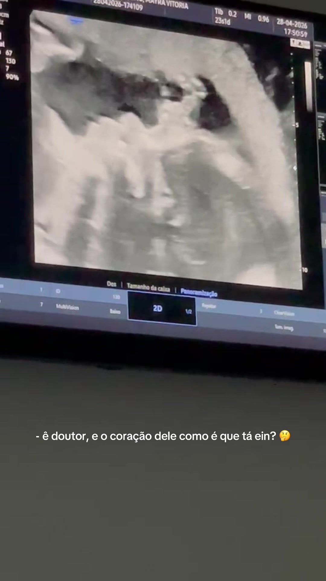 @May Alves