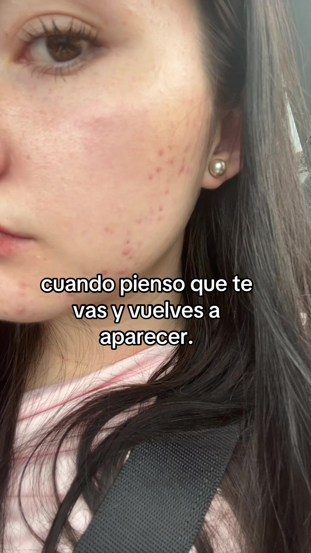 @Ani