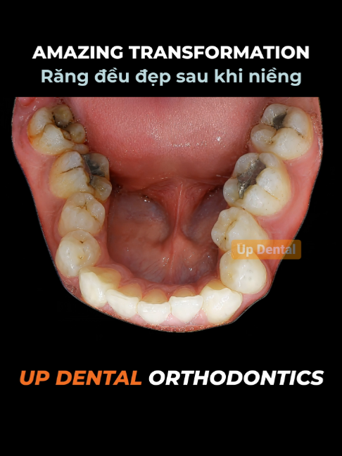 @Nha khoa niềng răng Up Dental