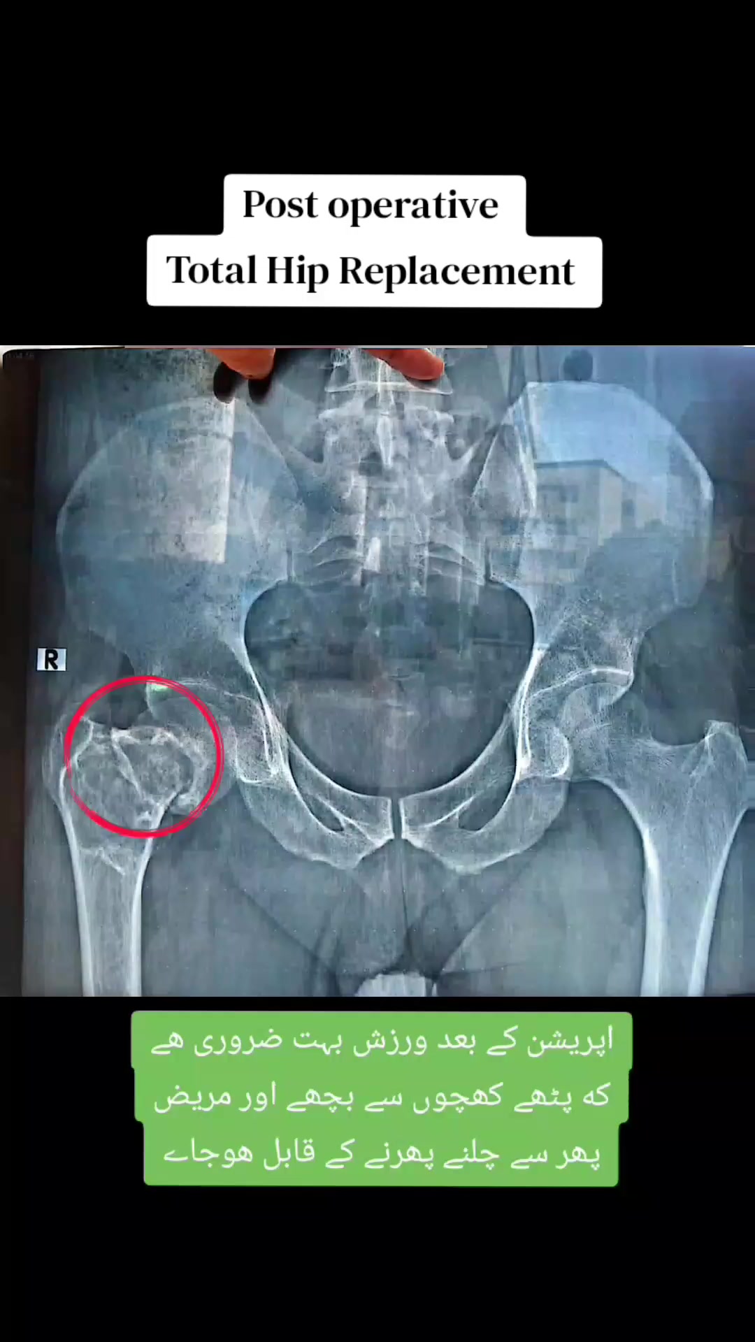 @Dr wadood