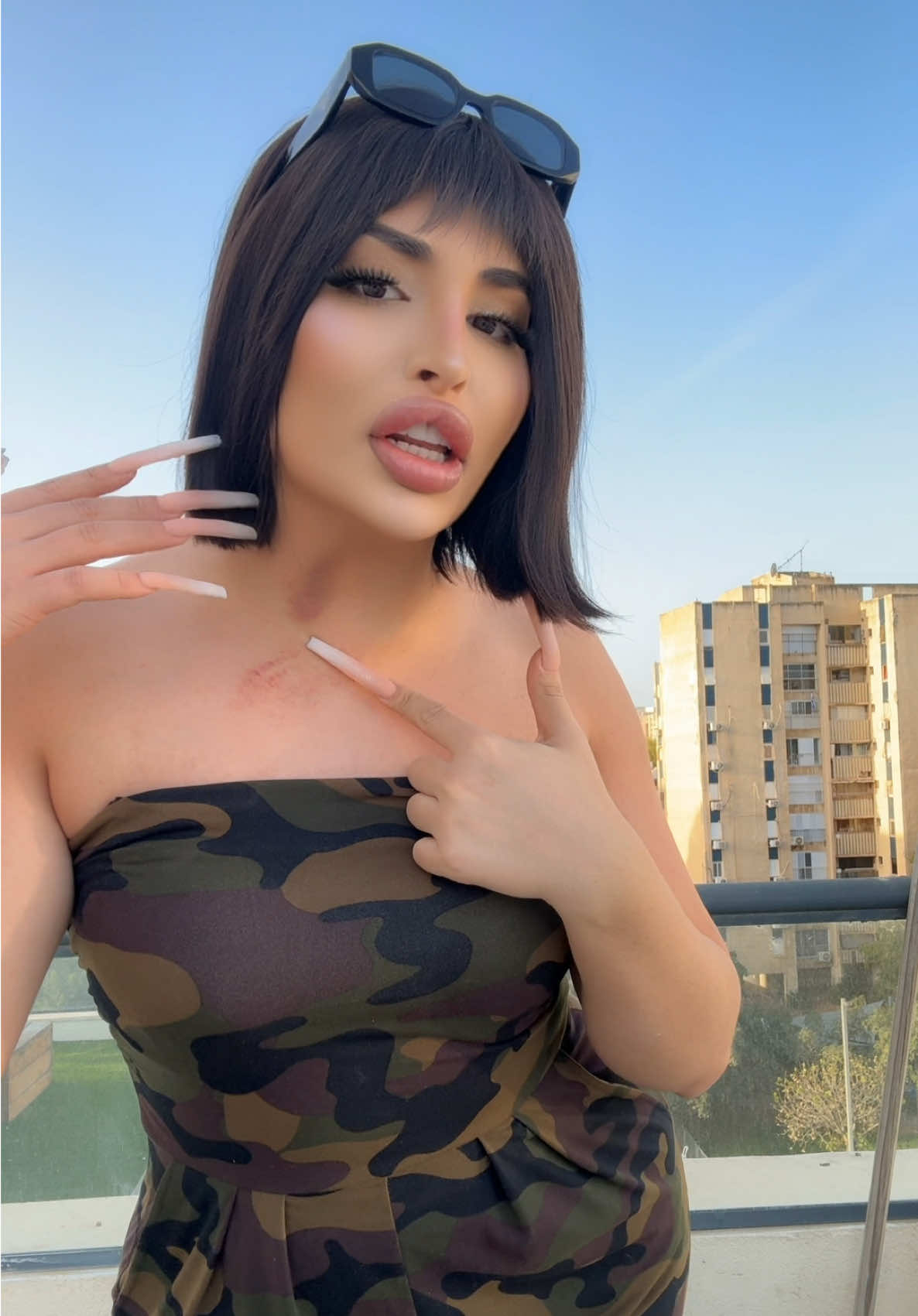 @Saher Monther