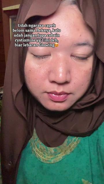 @ita_skinjourney