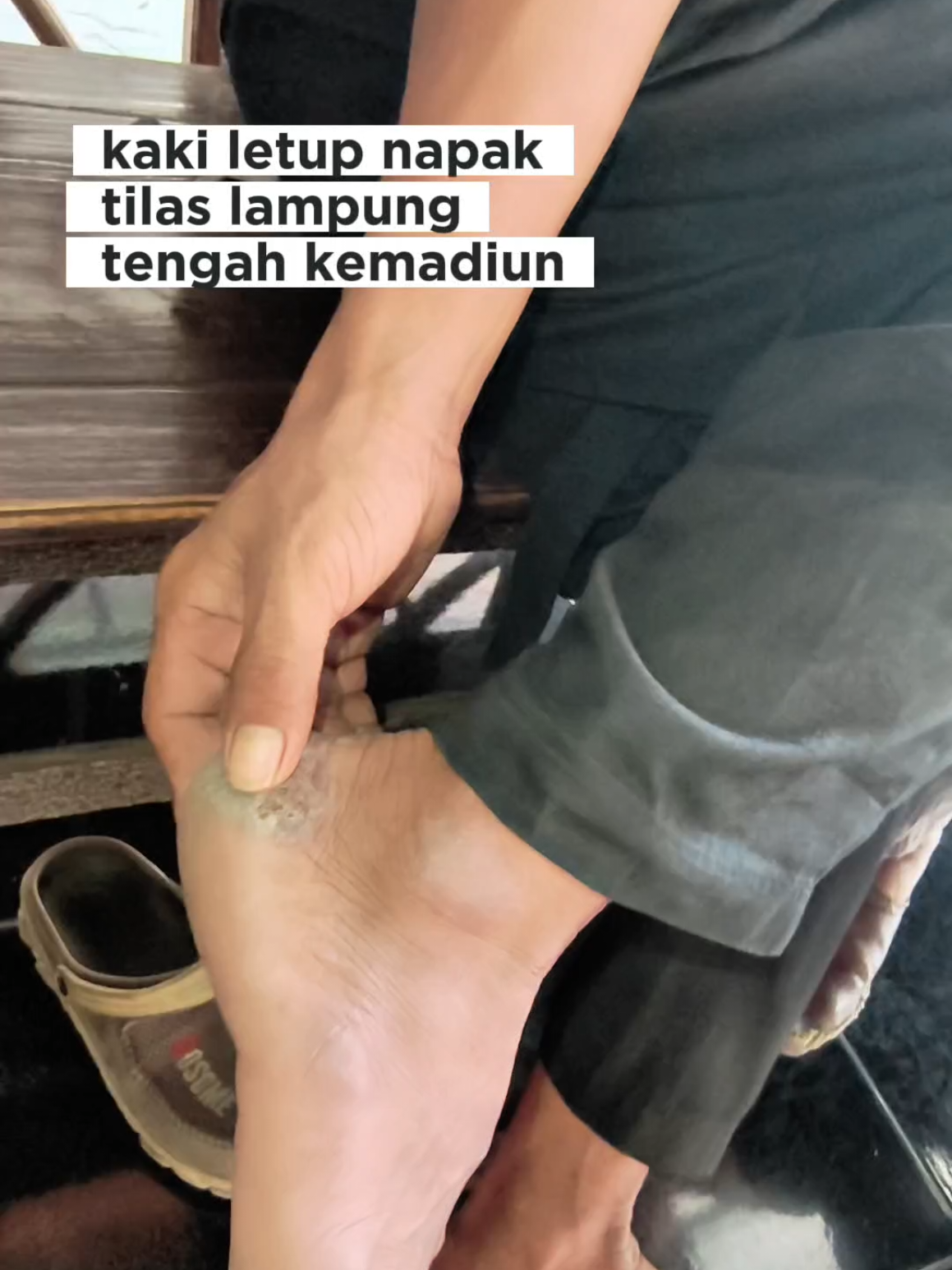 @Denny Aprisani