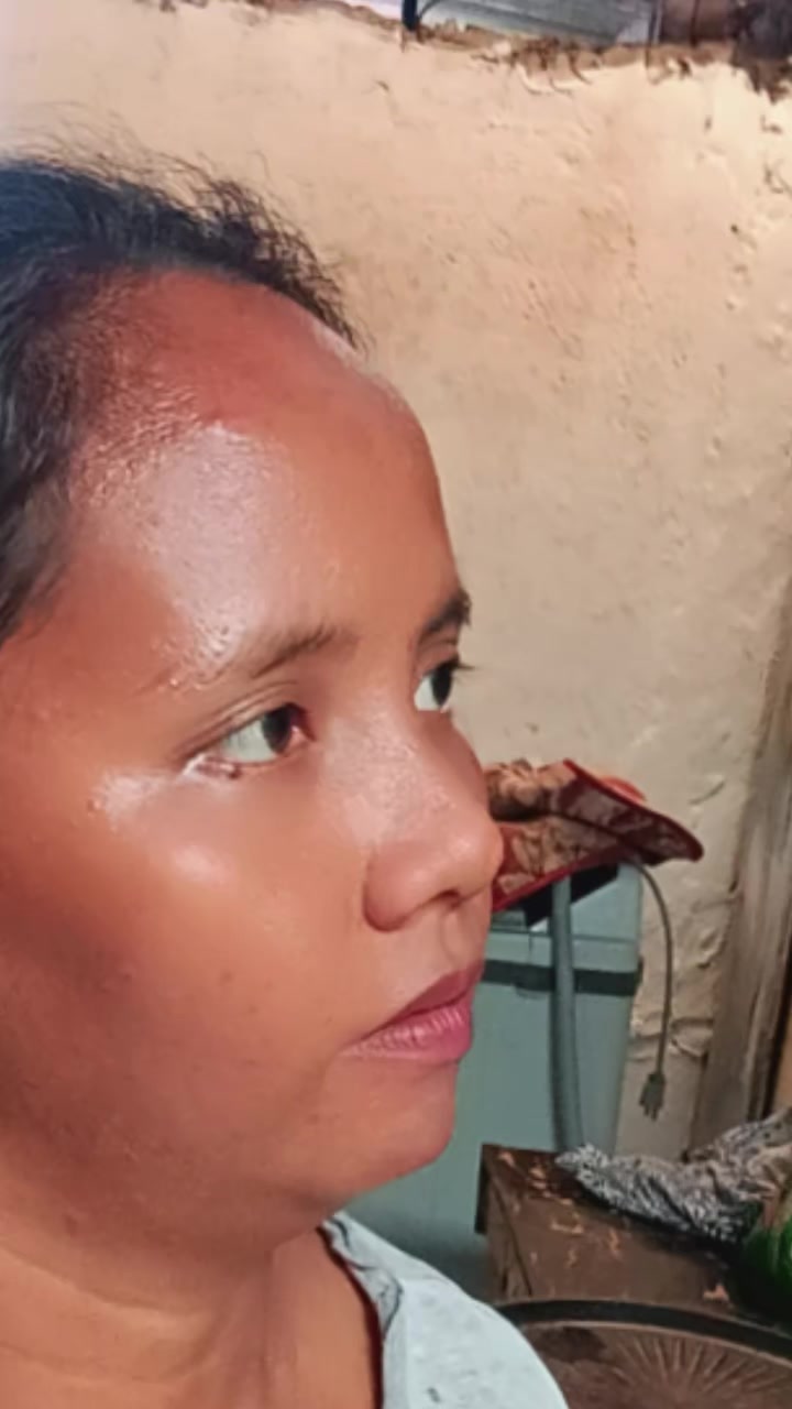 @bungal🤪✅