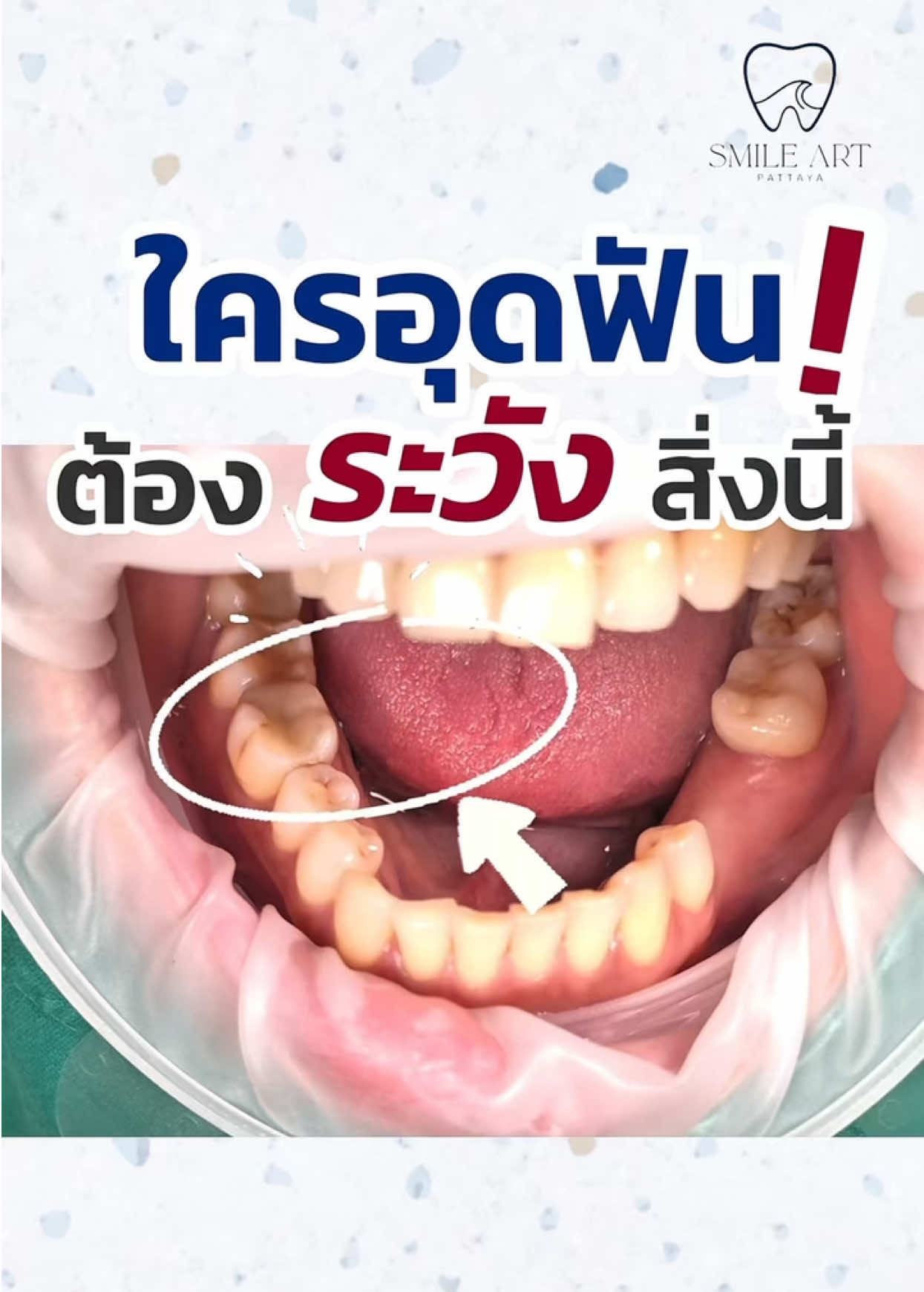 @smile Art Pattaya