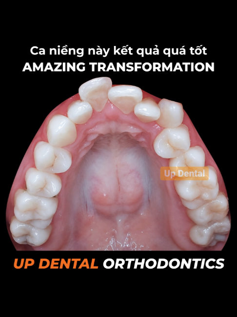 @Nha khoa niềng răng Up Dental