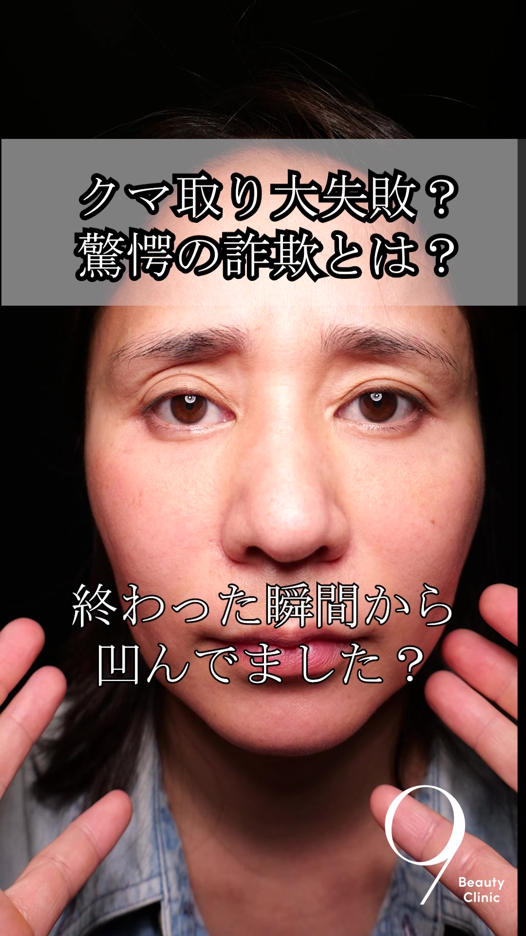 @りく先生　目元切開/クマ治療