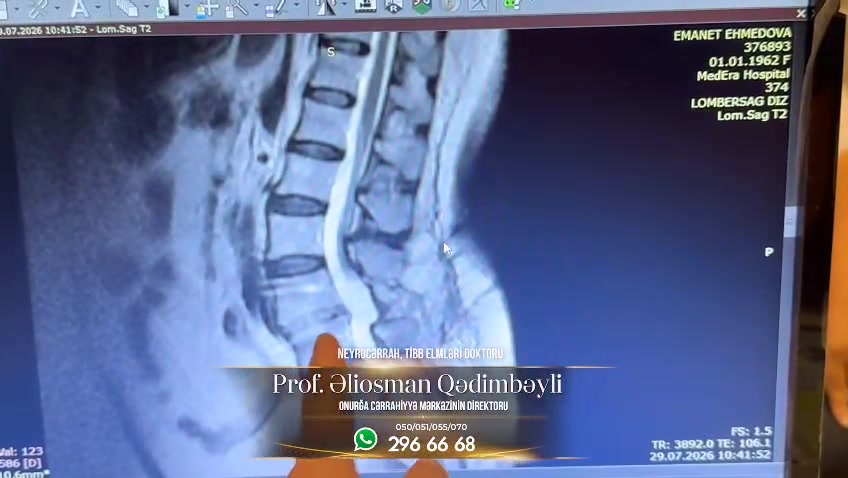 @Aliosman kadımbeylı