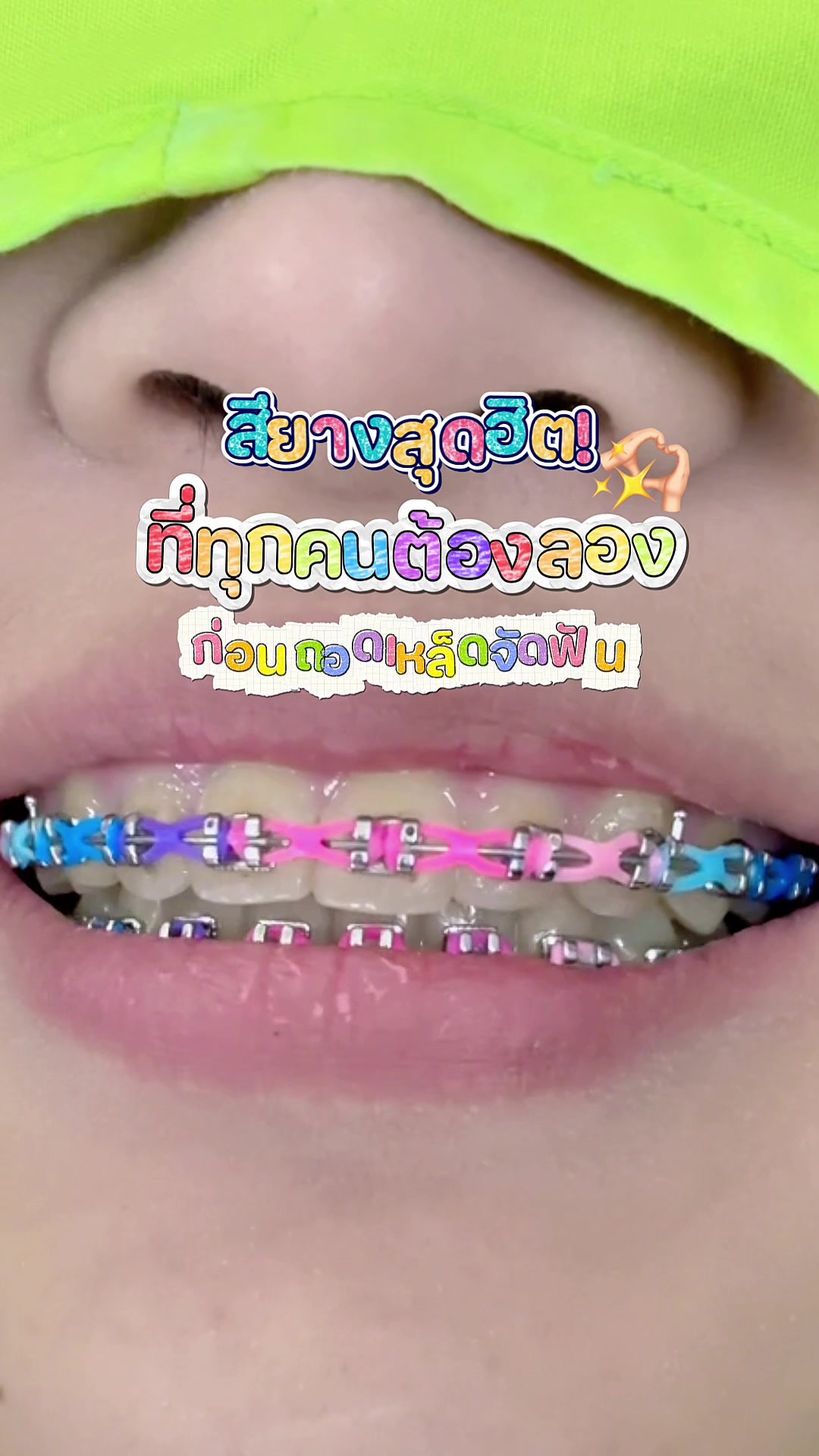 @ideasmiledentalclinic