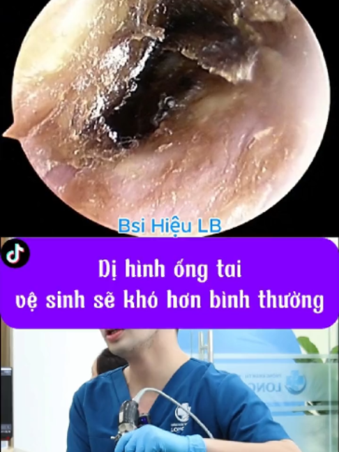 @Bs Hiệu Tai Mũi Họng Long Biên