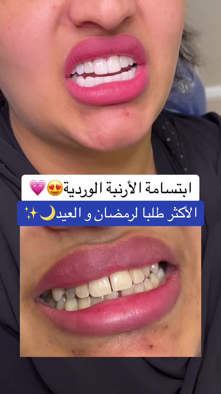 @عيادات البا للابتسامة