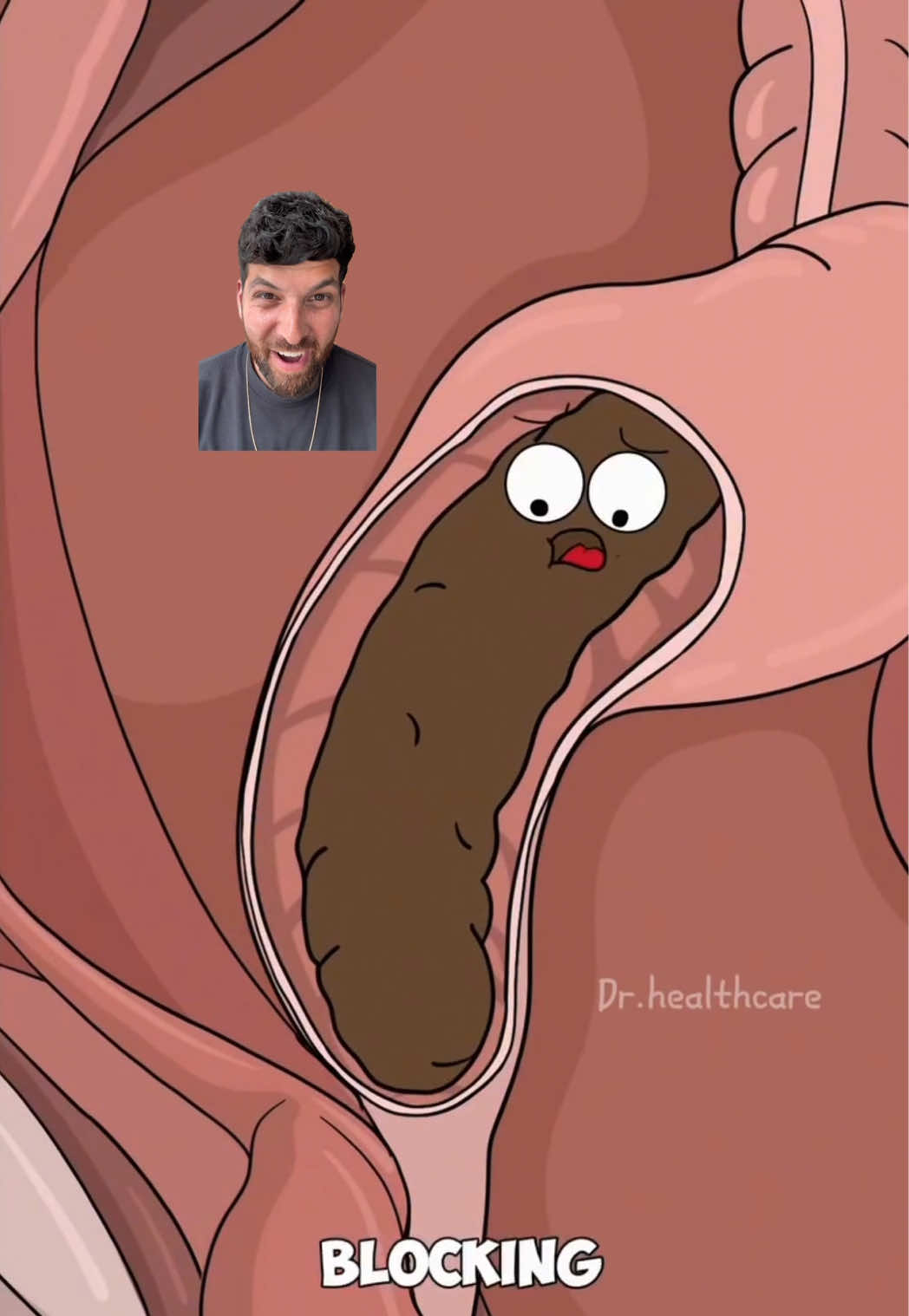 @Mr.Colitiscrohns