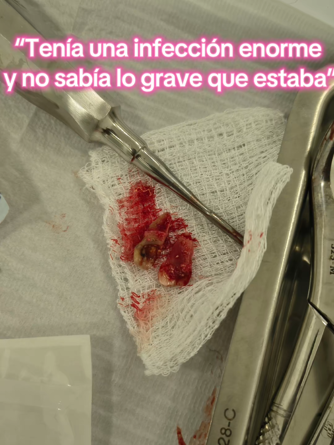 @Mica