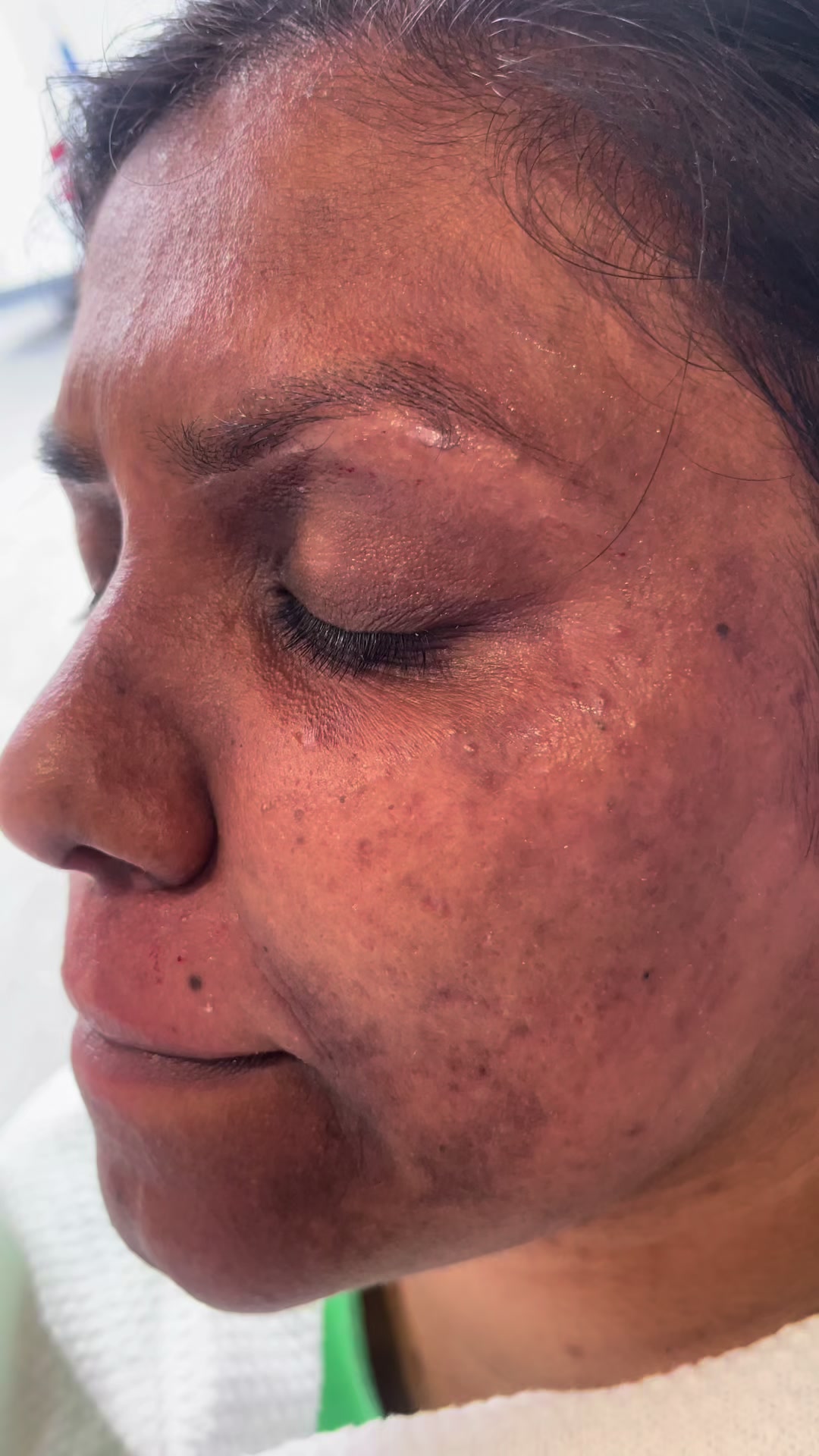 @THILI SKIN CARE CENTER