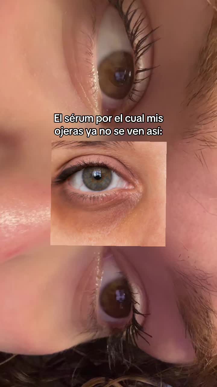 @vero