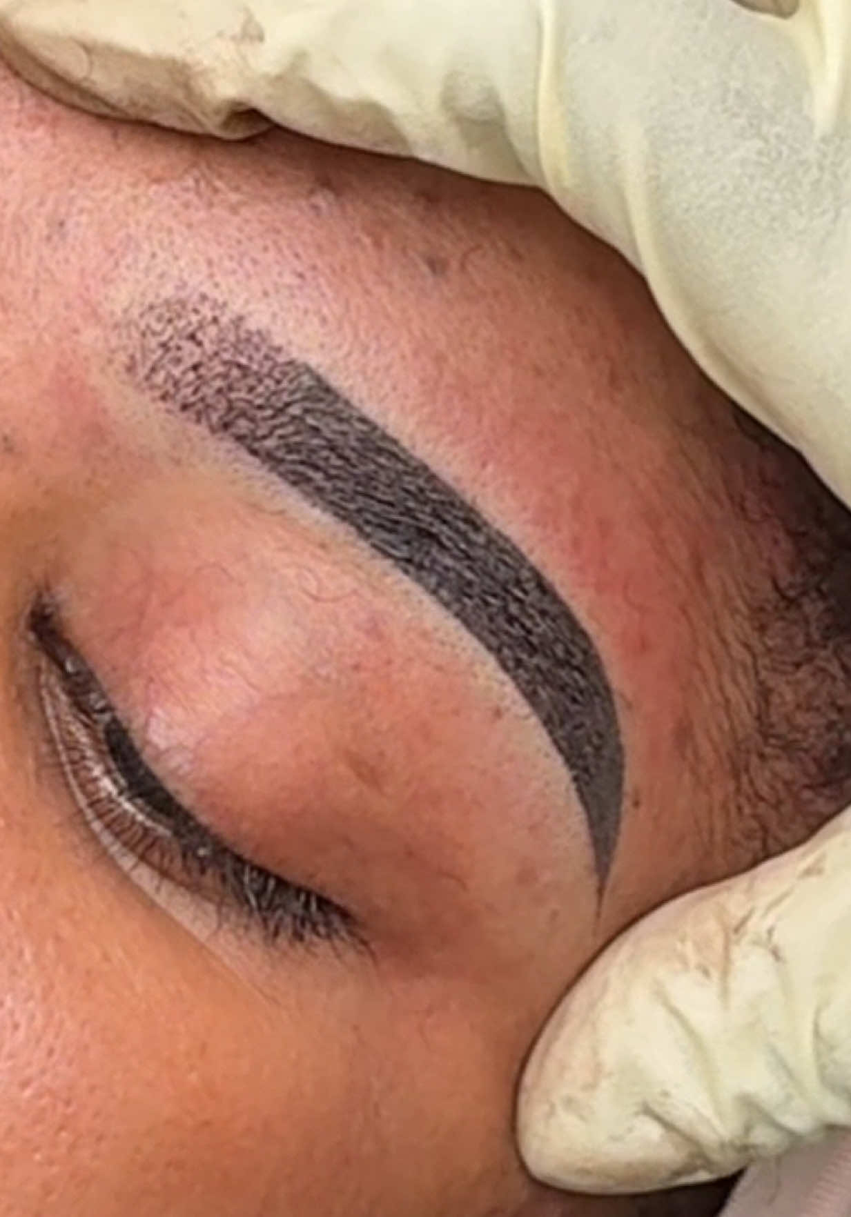 @the_brow_surgeon