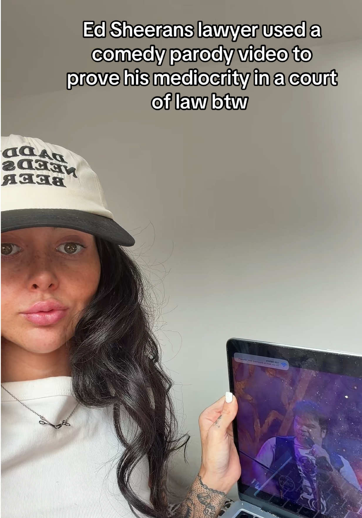@CLARA ๐