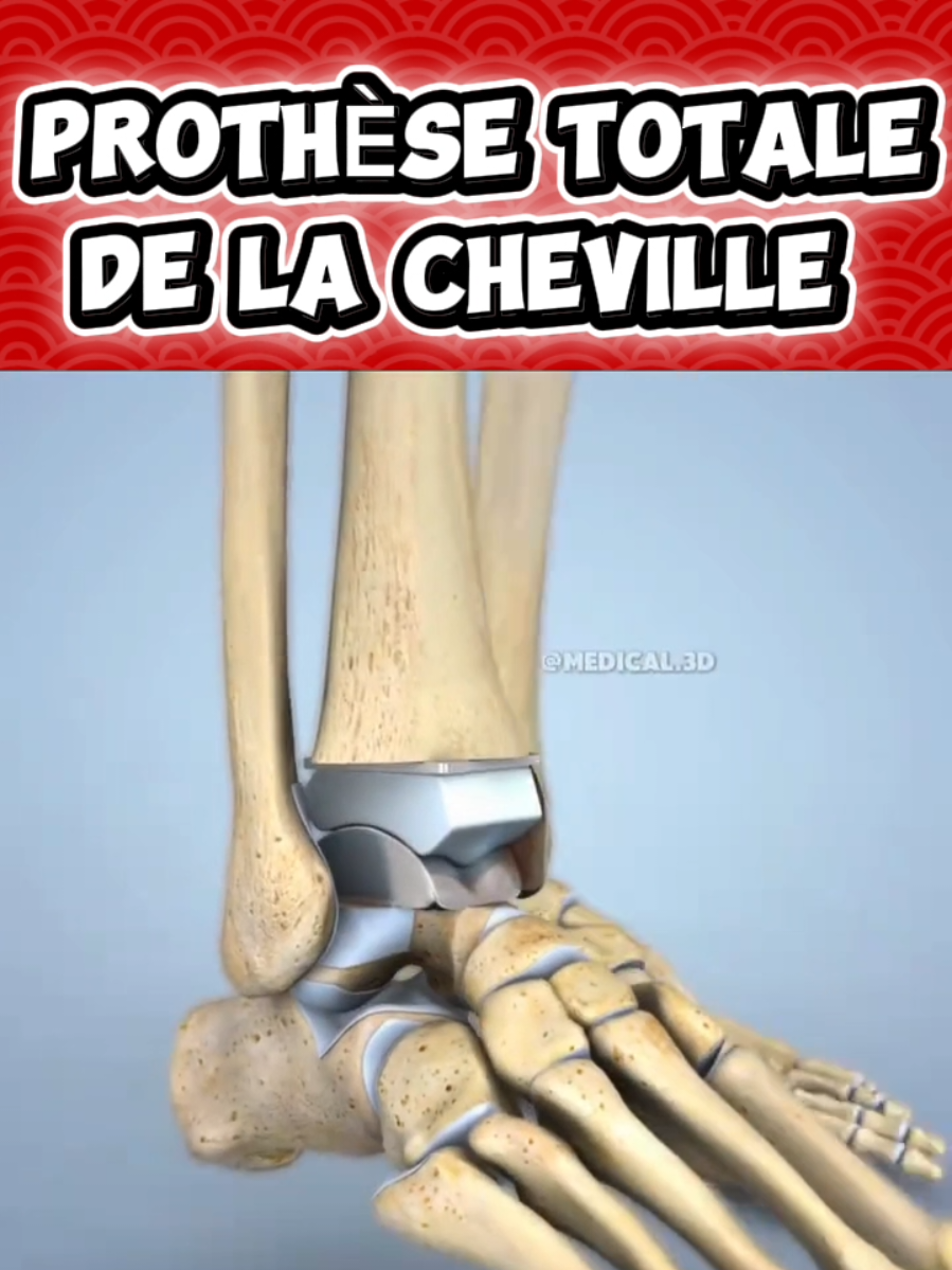@Docteur Shepherd