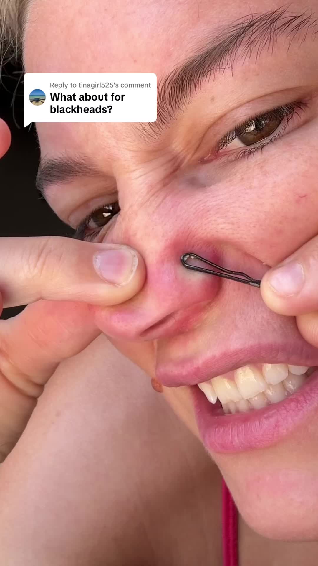 @Bri
