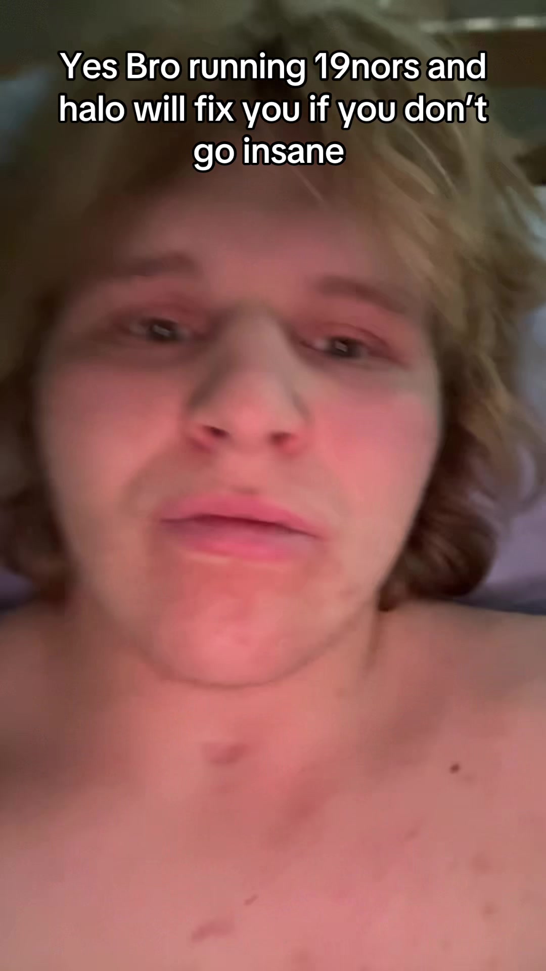 @#1 paralyzed Mogger