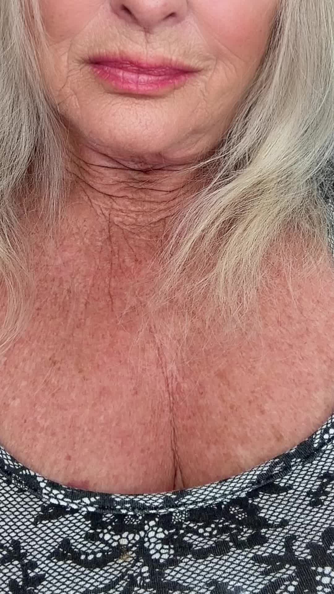 @schnattermelli
