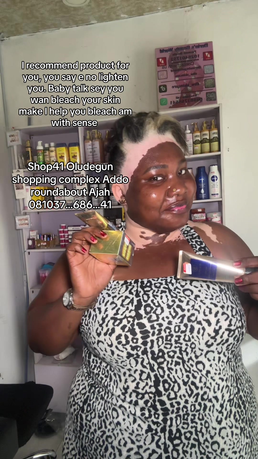 @Thevitiligogirl
