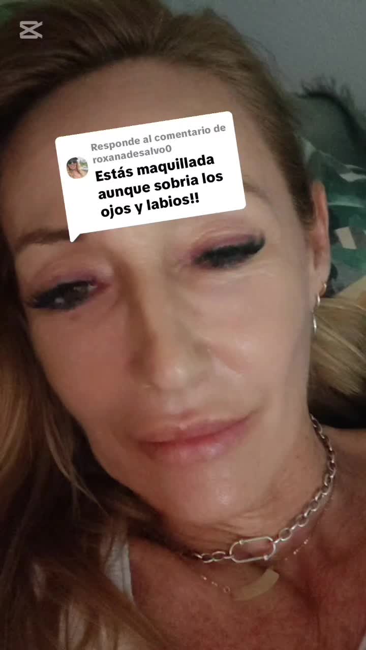 @Anuska