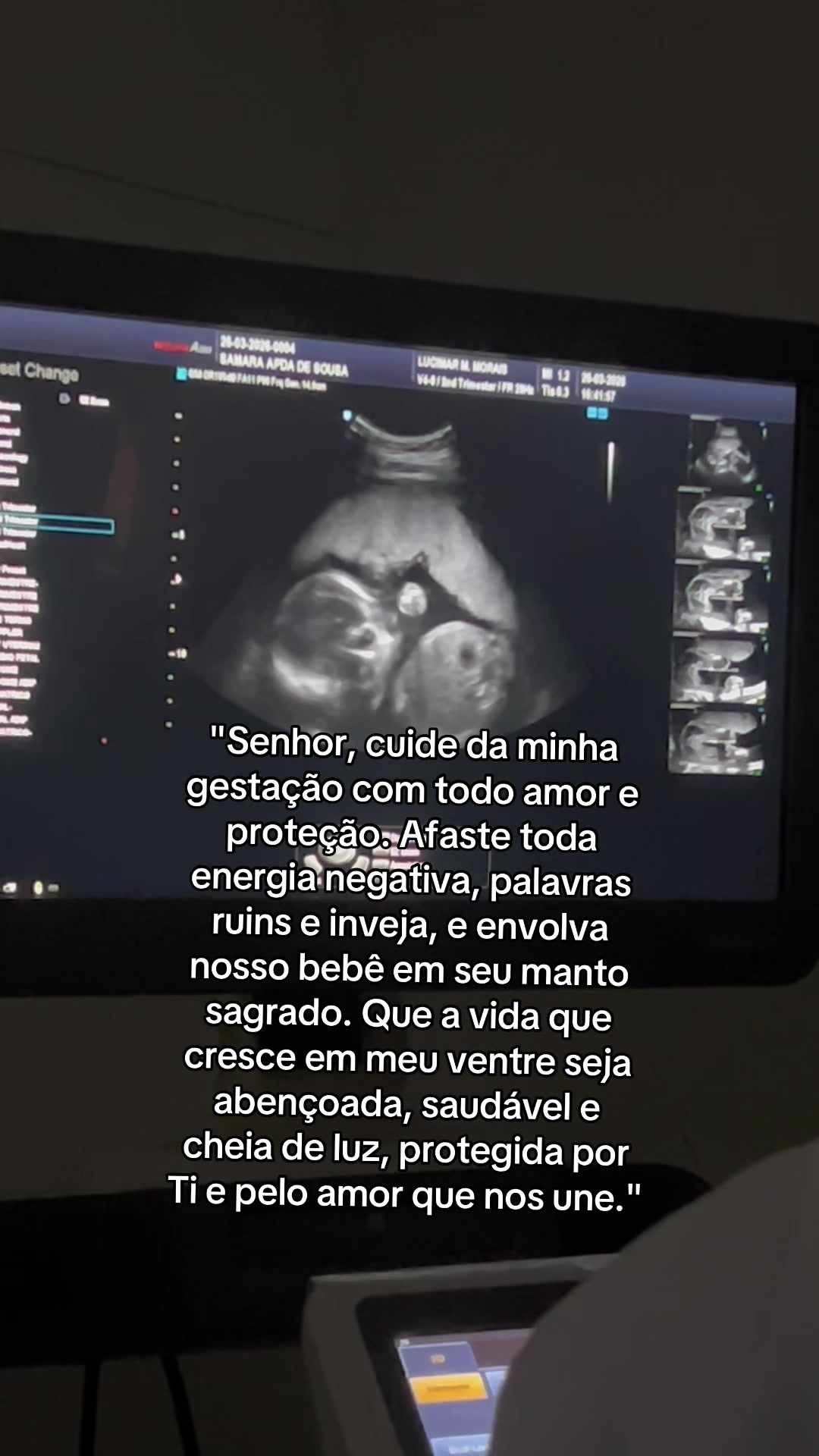 @Samara Sousa