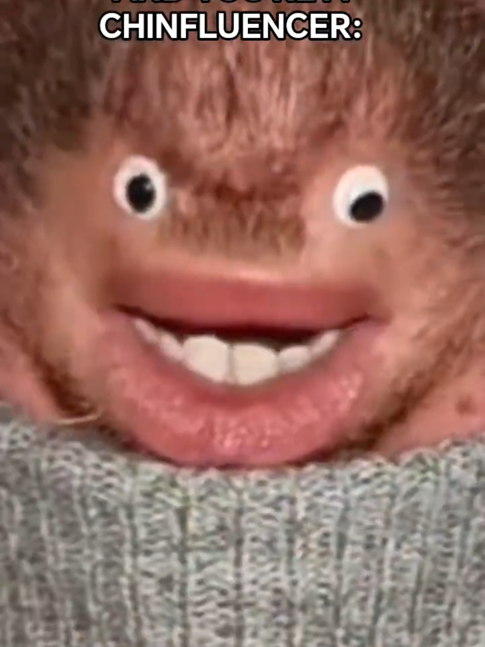 @Chinfaced