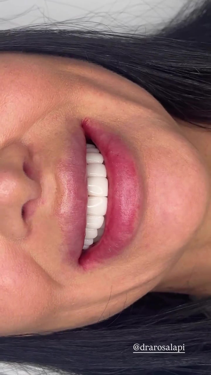 @Artista de sonrisas
