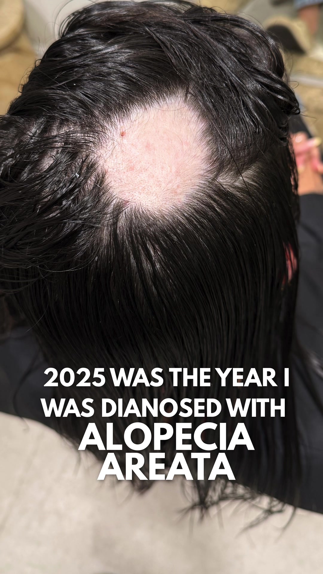 @TheBaldTruth