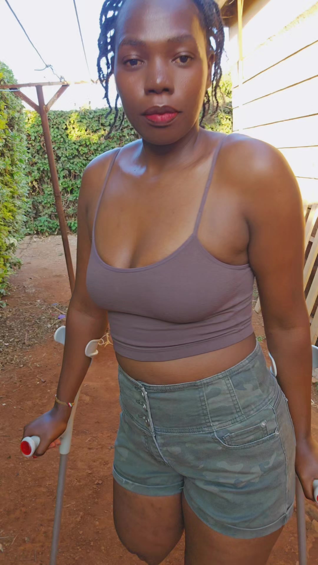 @💎Nattie Amputee🇰🇪♊️