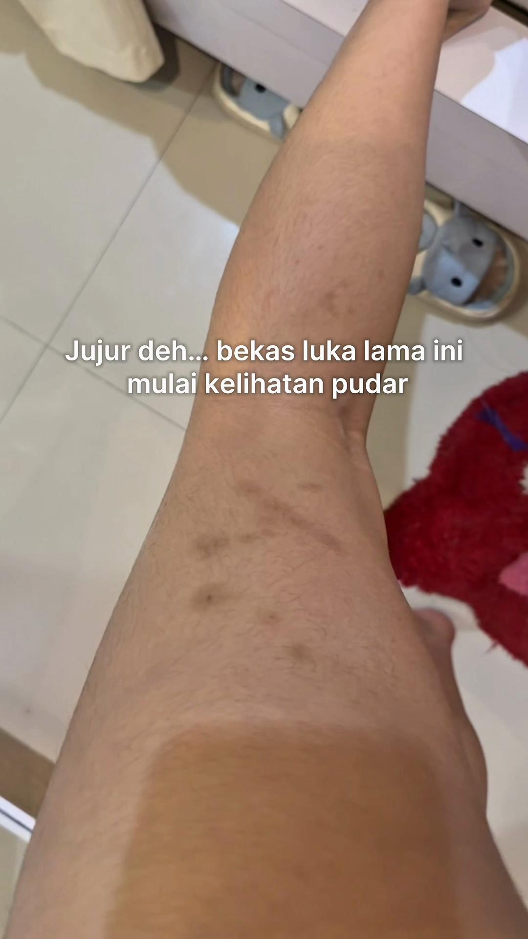 @dindapradnya