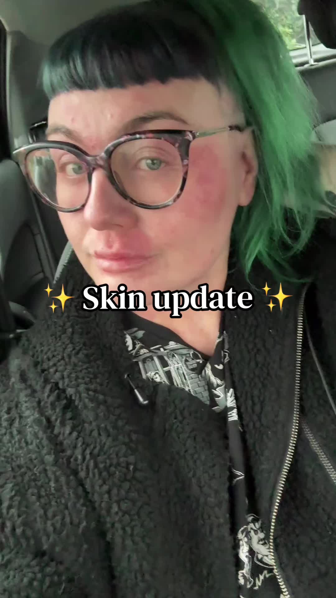 @Emma