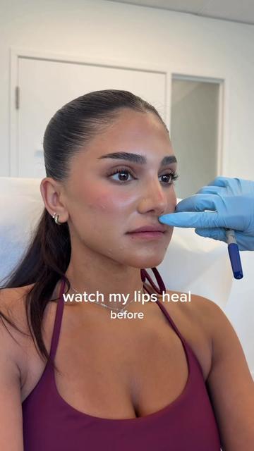 @Kim